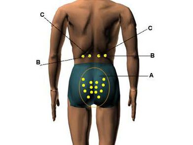 Acupuncture for potonia