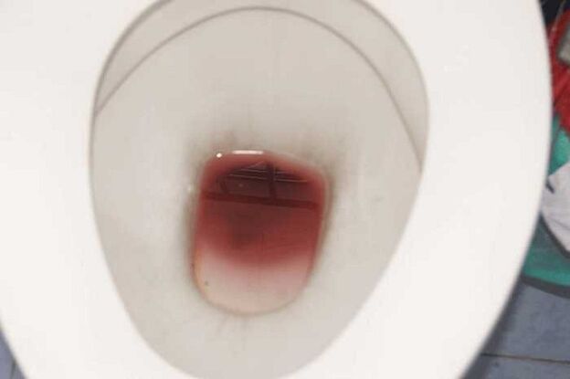 spots in men when excited